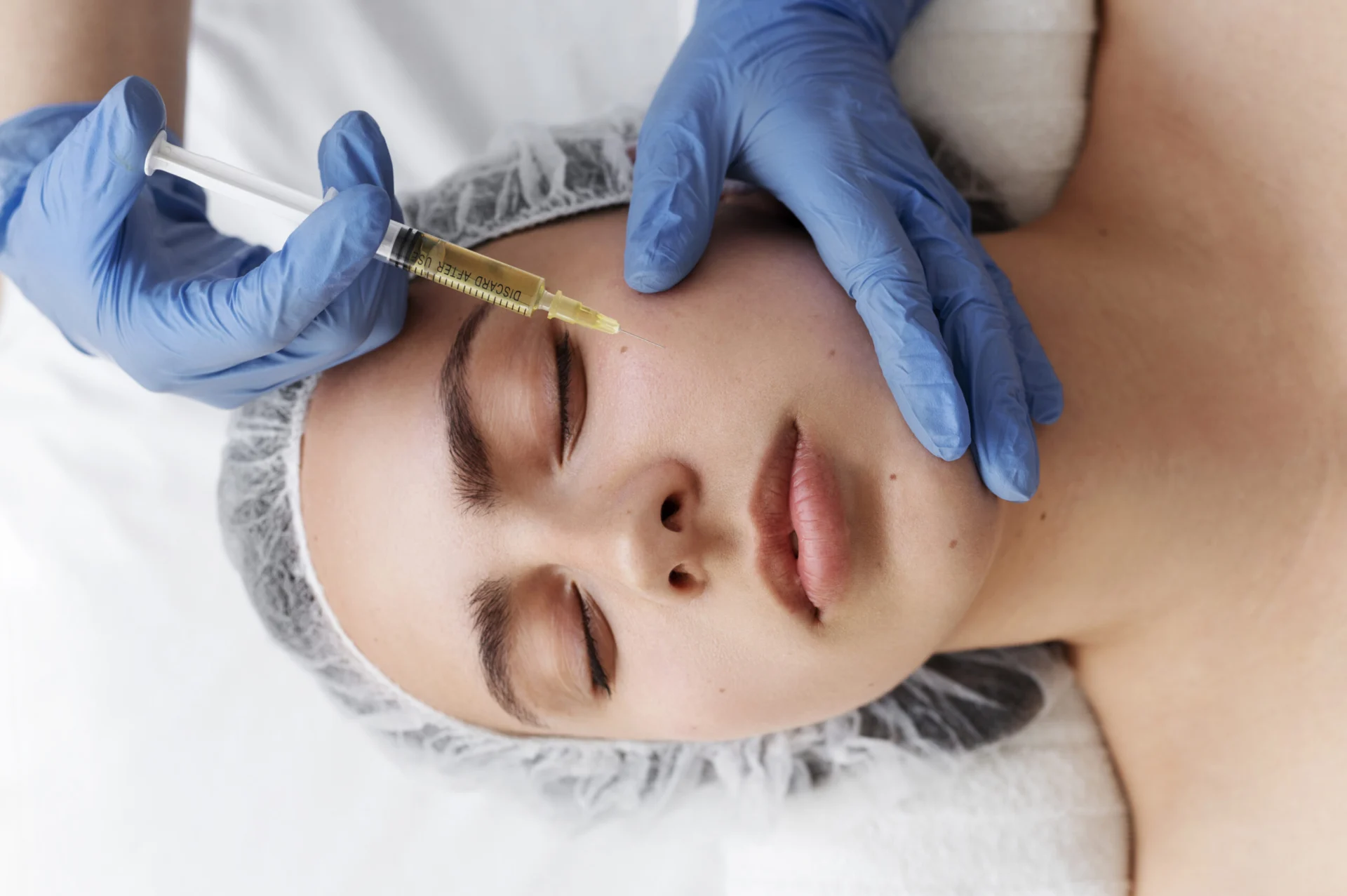 microneedling and prp