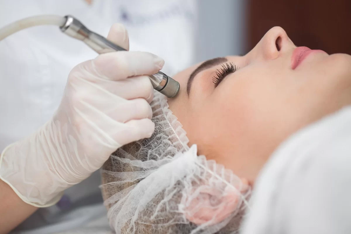 microdermabrasion vs chemical peel
