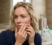 Acne treatment Bali di Moii Aesthetic Clinic